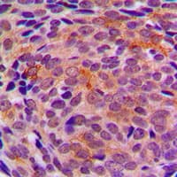 LYPLA1 Antibody (Internal)
