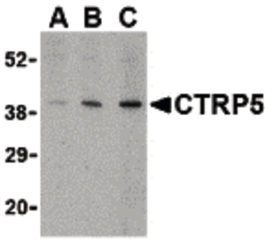 IHC-plus™ Polyclonal Rabbit anti-Human C1QTNF5 / CTRP5 Antibody (IHC, WB)