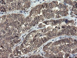 TBCC Antibody (clone OTI2D1)