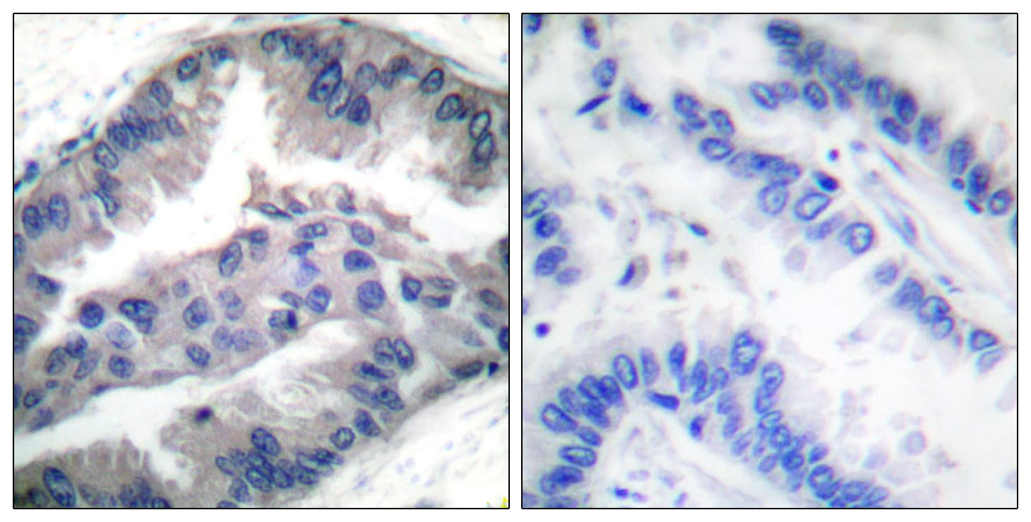 Polyclonal Rabbit anti-Human BIK Antibody (phospho-Thr33, IHC, WB)