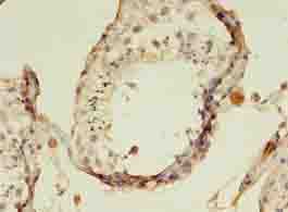 KATII / AADAT Antibody
