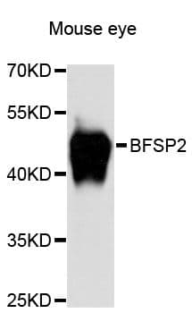 Polyclonal Rabbit anti-Human BFSP2 Antibody (WB)