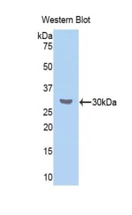 CETP Antibody (aa232-487)