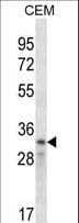 IHC-plus™ CCND2 / Cyclin D2 Antibody (aa1-30)