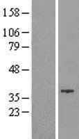 GTDC1 Protein (Over-Expression Lysate Myc-DDK (Flag))