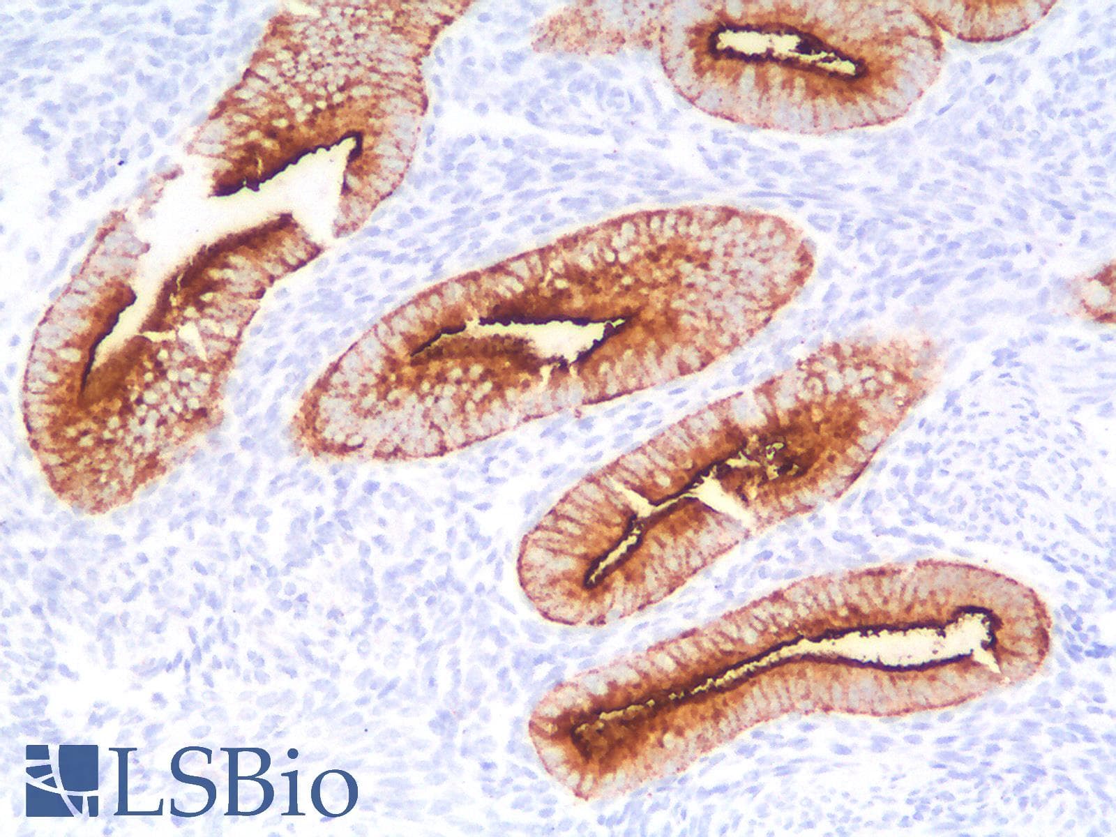 PathPlus™ EMA / MUC1 Antibody (clone MUC1/1887R)
