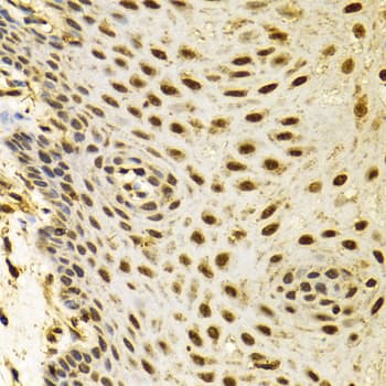 Polyclonal Rabbit anti-Human POLR2C Antibody (IHC, WB)