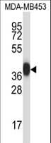 PRSS8 / Prostasin Antibody (aa190-219)