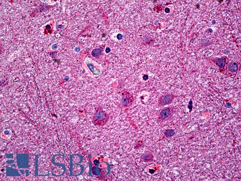 IHC-plus™ NTM / Neurotrimin Antibody (aa235-284)