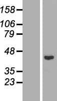RAD51B Protein (Over-Expression Lysate Myc-DDK (Flag))