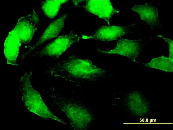 Monoclonal Mouse anti-Human SSR2 Antibody (clone 4C1, IF, WB)