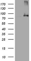 NBN / Nibrin Antibody (clone OTI6H7)