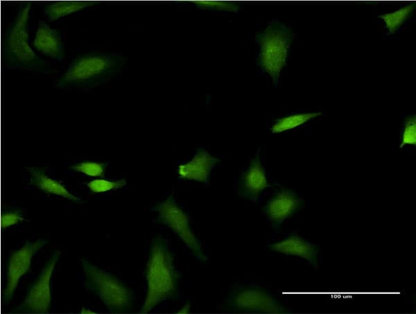 FNTB Antibody (clone 3A9)