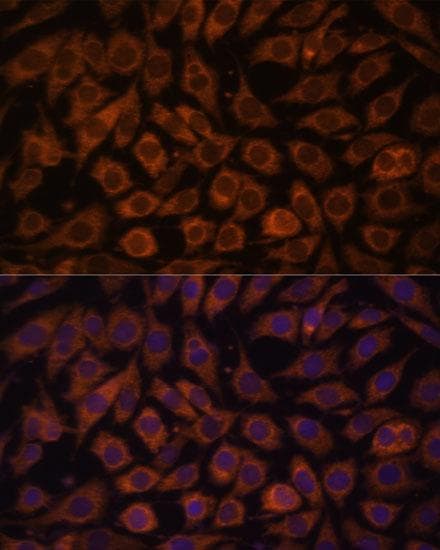TLR3 Antibody