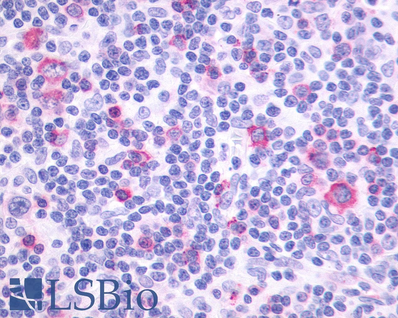 PathPlus™ PTGIR / IP Receptor Antibody (N-Terminus)
