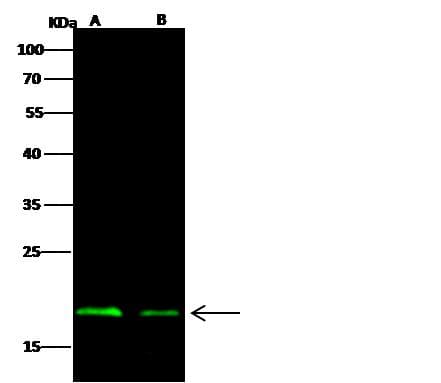 NucleoProtein Antibody (Preservative Free)