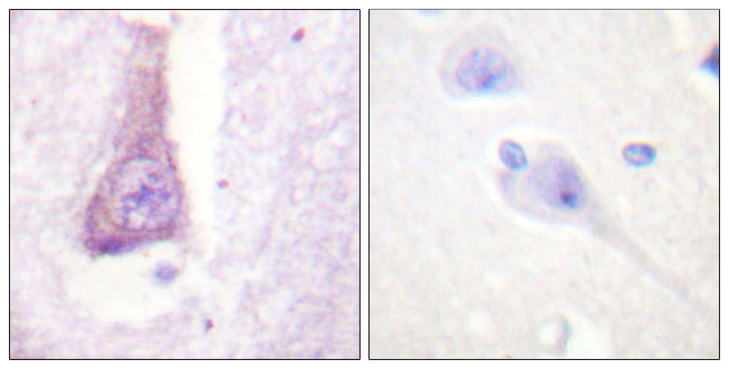 WAS / WASP Antibody (aa256-305)
