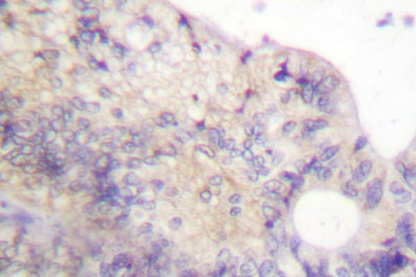 PFKFB2 Antibody (Pro479)
