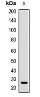 SRSF9 / SFRS9 Antibody