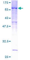 Human PPP2R5D Protein (Recombinant GST)