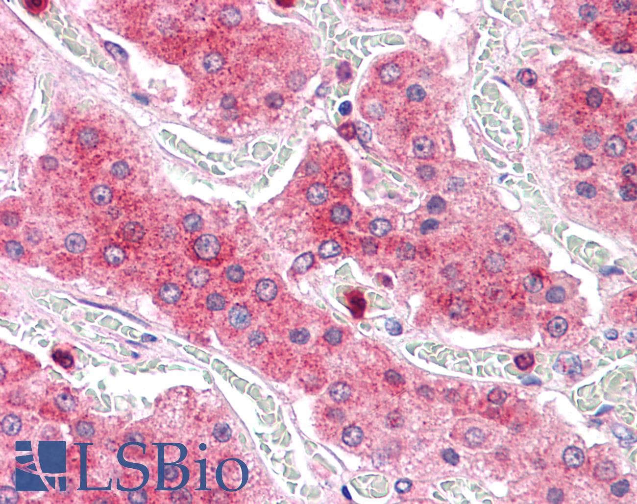 IHC-plus™ COMT Antibody (Internal)