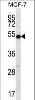 COIL / Coilin Antibody (aa157-186)