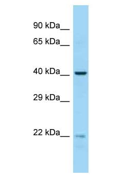 EME2 Antibody (aa174-223)