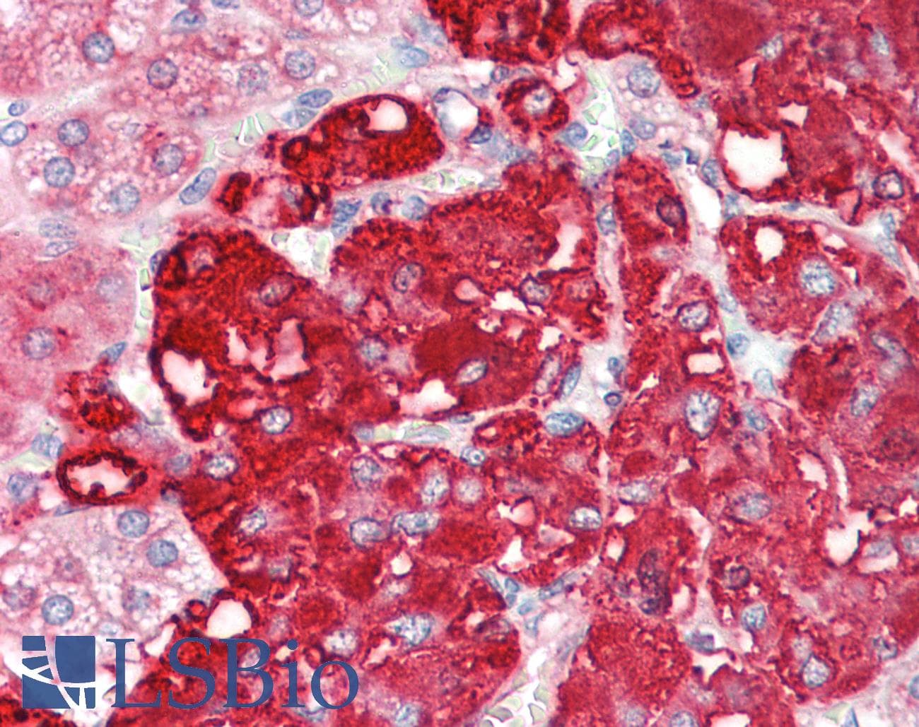IHC-plus™ CMPK2 Antibody