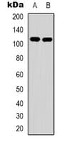 EPHA1 / EPH Receptor A1 Antibody (Internal)
