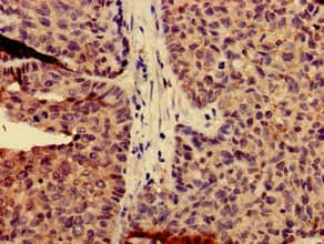 CAPN14 Antibody