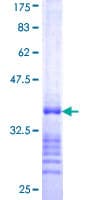 Human SOX2 Protein (Recombinant GST, N-terminus)
