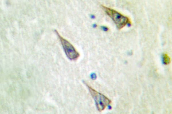 SEMA4A / Semaphorin 4A Antibody (aa500-546)