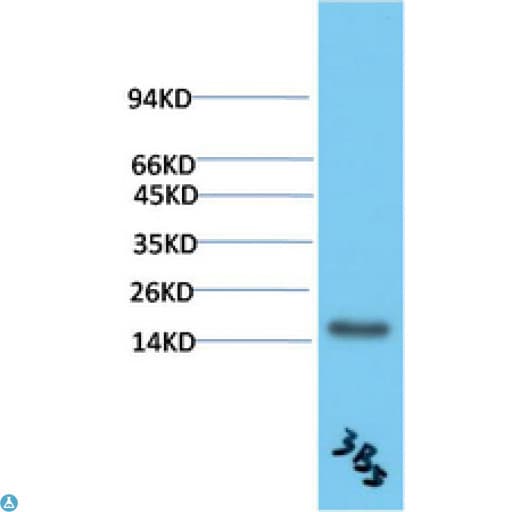 TTR / Transthyretin Antibody
