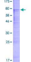 Human Acrosin Protein (Recombinant GST)