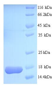 Entamoeba histolytica ABCB1 / MDR1 / P Glycoprotein (Recombinant His)