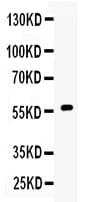 Polyclonal Rabbit anti-Human CYP17 / CYP17A1 Antibody (IHC, WB)