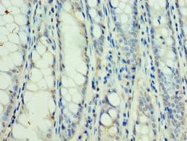 Polyclonal Rabbit anti-Human SSNA1 Antibody (aa1-119, IHC)