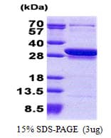 Human CCDC25 Protein (Recombinant His)