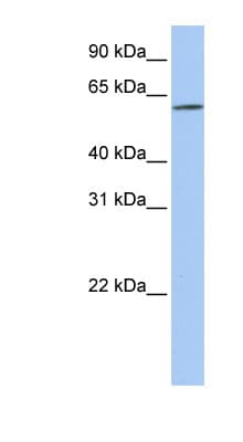 Polyclonal Rabbit anti-Human SLC22A14 Antibody (aa144-193, WB)