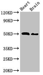 Polyclonal Rabbit anti-Human SKD1 / VPS4B Antibody (IHC, IF, WB)