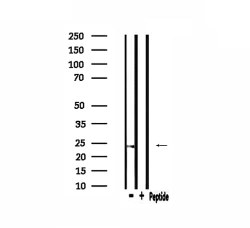 HSPB2 / HSP27 Antibody
