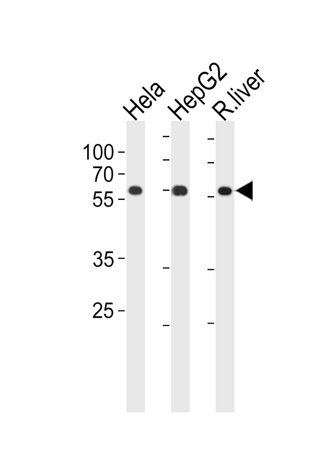 POLD2 Antibody (aa237-265)