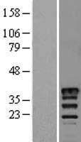 MSI2 Protein (Over-Expression Lysate Myc-DDK (Flag))