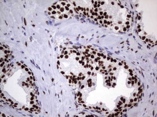 DDX56 Antibody (aa323-547, clone UMAB152)