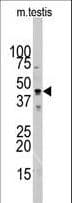 ACTC1 / Alpha Cardiac Actin Antibody (aa38-67)