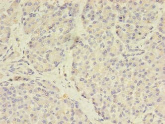 Polyclonal Rabbit anti-Human TSAP6 / STEAP3 Antibody (IHC, WB)