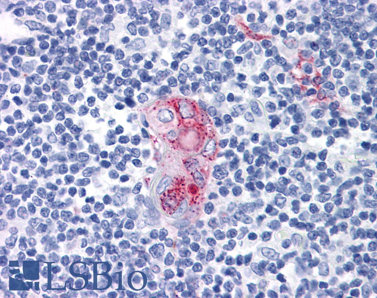 IHC-plus™ CD1D Antibody (clone 51.1)