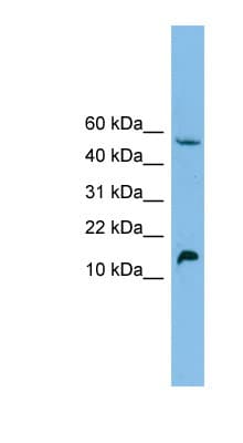 EPO / Erythropoietin Antibody (C-Terminus)