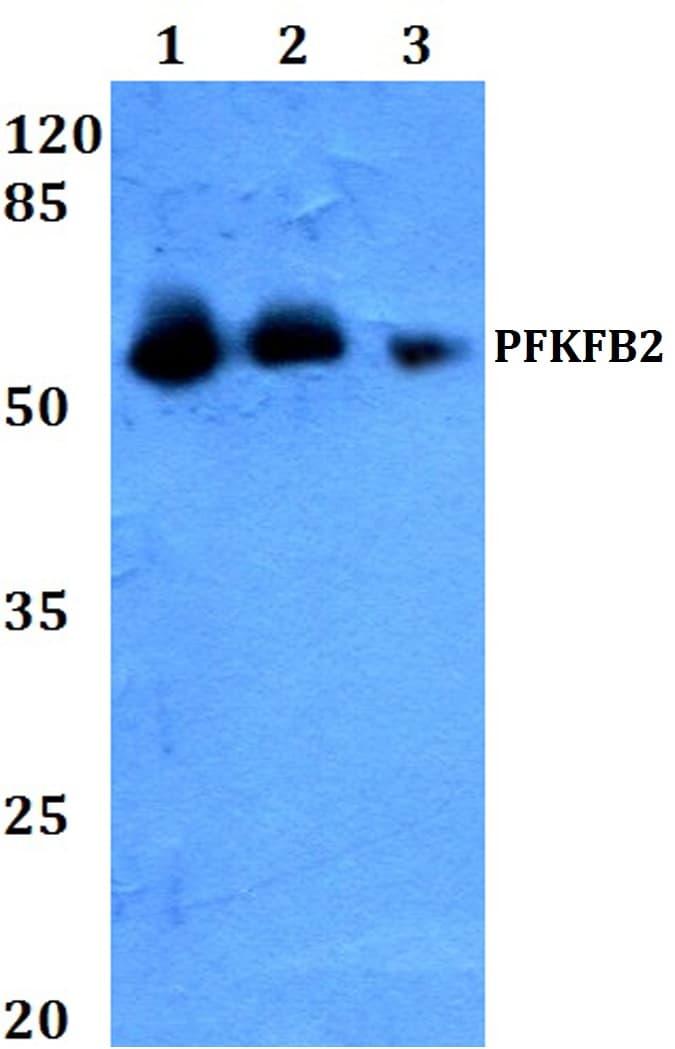 Polyclonal Rabbit anti-Human PFKFB2 Antibody (Tyr14, IHC, WB)