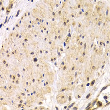 IHC-plus™ Polyclonal Rabbit anti-Human TMPRSS2 / Epitheliasin Antibody (IHC, WB)